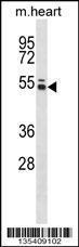 Anti-PTK6 Rabbit Polyclonal Antibody