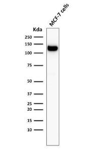 Western blot analysis of MCF-7 cell lysate using Anti-E Cadherin Antibody [4A2]