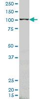 Anti-ARHGEF1 Mouse Monoclonal Antibody [clone: 4C4]