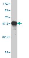 Anti-RASGRP4 Mouse Monoclonal Antibody [clone: 1F3]