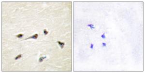 Immunohistochemical analysis of paraffin-embedded human brain tissue using Anti-AKAP12 Antibody. The right hand panel represents a negative control, where the antibody was pre-incubated with the immunising peptide.