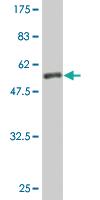 Anti-FAIM2 Mouse Monoclonal Antibody [clone: 2C2]