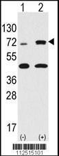 Anti-RPS6KA3 Rabbit Polyclonal Antibody (AP (Alkaline Phosphatase))