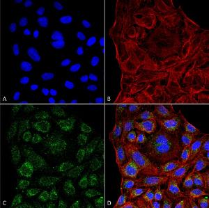 Immunocytochemistry/Immunofluorescence analysis of human cervical cancer cell line (HeLa), fixed in 4% formaldehyde for 15  min at room temperature, using Anti-ERp57 Antibody [4F9] (A304860), at 1:100 for 60  minutes at room temperature.Rp57 Antibody. (D) Composite