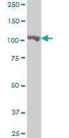 Anti-MARS Mouse Monoclonal Antibody [clone: 5G5]