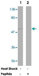 Anti-AKT1 Rabbit Polyclonal Antibody