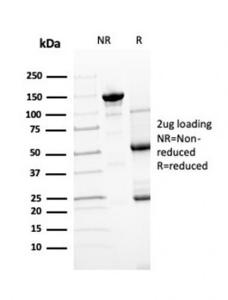 SDS-PAGE analysis of Anti-Transthyretin Antibody [TTR/4295] under non-reduced and reduced conditions; showing intact IgG and intact heavy and light chains, respectively. SDS-PAGE analysis confirms the integrity and purity of the antibody