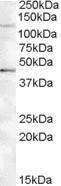 Anti-TNKS2 antibody