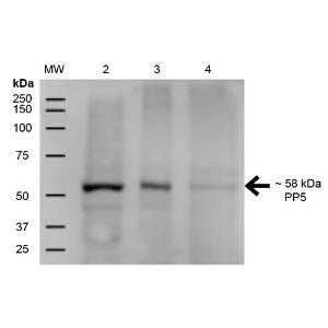 Anti-PP-T Mouse Monoclonal Antibody [clone: 12F7]