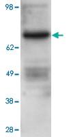 Anti-PRKCB Rabbit Polyclonal Antibody