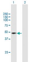 Anti-PNKD Mouse Polyclonal Antibody