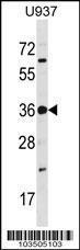 Anti-TP53RK Rabbit Polyclonal Antibody (HRP (Horseradish Peroxidase))