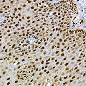 Immunohistochemistry analysis of paraffin-embedded human esophagus using Anti-SCAF4 Antibody (A308954) at a dilution of 1:50 (40X lens). Perform high pressure antigen retrieval with 10 mM citrate buffer pH 6.0 before commencing with IHC staining protocol