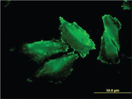 Anti-MARS Mouse Monoclonal Antibody [clone: 5G5]