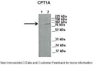 Anti-CPT1A Rabbit Polyclonal Antibody