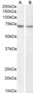 Anti-LMNB1 Antibody (A82838) (1 µg/ml) staining of HeLa (A) and Jurkat (B) nuclear lysate (35 µg protein in RIPA buffer). Primary incubation was 1 hour. Detected by chemiluminescence