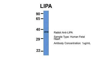 Anti-LIPA Rabbit Polyclonal Antibody