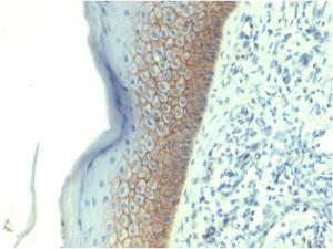 Immunohistochemical analysis of formalin-fixed, paraffin-embedded human skin using Anti-E Cadherin Antibody [CDH1/1525]