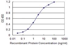 Anti-MARS Mouse Monoclonal Antibody [clone: 5G5]