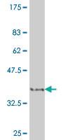 Anti-HIPK2 Mouse Monoclonal Antibody [clone: 1D8]