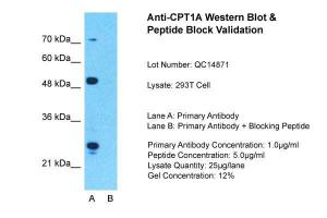 Anti-CPT1A Rabbit Polyclonal Antibody