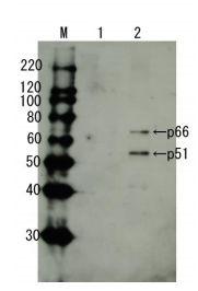 Anti-HIV1 Reverse Transcriptase Antibody