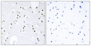 Immunohistochemical analysis of paraffin-embedded human brain tissue using Anti-c-Jun Antibody. The right hand panel represents a negative control, where the antibody was pre-incubated with the immunising peptide