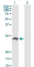 Anti-WISP2 Mouse Monoclonal Antibody [clone: 3D10]