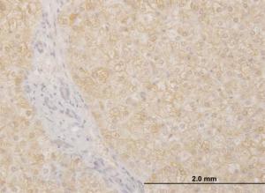 Anti-POMGNT1 Mouse Monoclonal Antibody [clone: 6C12]