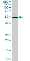 Anti-BAG5 Rabbit Polyclonal Antibody