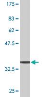 Anti-MAPK3 Mouse Monoclonal Antibody [clone: 1F7]