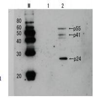 Anti-HIV1 p24 Antibody