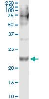 Anti-WISP2 Mouse Monoclonal Antibody [clone: 3D10]