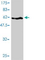 Anti-SERPINH1 Mouse Monoclonal Antibody [clone: 1D2-1A6]