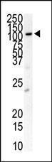 Anti-FLT3 Rabbit Polyclonal Antibody (HRP (Horseradish Peroxidase))