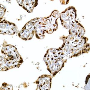 Immunohistochemistry analysis of paraffin-embedded human placenta using Anti-SCAF4 Antibody (A308954) at a dilution of 1:50 (40X lens). Perform high pressure antigen retrieval with 10 mM citrate buffer pH 6.0 before commencing with IHC staining protocol