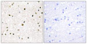 Immunohistochemical analysis of paraffin-embedded human brain tissue using Anti-AKAP11 Antibody. The right hand panel represents a negative control, where the antibody was pre-incubated with the immunising peptide.