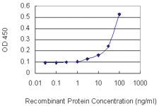 Anti-MAT1A Mouse Monoclonal Antibody [clone: 4D11]