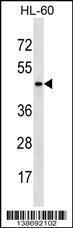 Anti-ARMCX4 Rabbit Polyclonal Antibody (APC (Allophycocyanin))