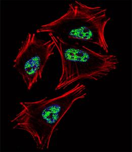 Anti-PROX1 Rabbit Polyclonal Antibody (AP (Alkaline Phosphatase))