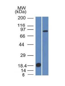 Western blot analysis of (A) recombinant E Cadherin protein and (B) human stomach lysate using Anti-E Cadherin Antibody [CDH1/1525]