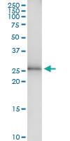 Anti-TSSK6 Polyclonal Antibody Pair