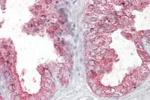 Anti-KLK2 Antibody (A82839) (3.8µg/ml) staining of paraffin embedded Human Prostate. Steamed antigen retrieval with citrate buffer pH 6, AP-staining.