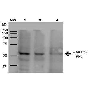 Western blot analysis of human A431, HEK293, and Jurkat cell lysates showing detection of ~58 kDa PP5 protein using Anti-PP-T Antibody [2E11] (A304862)