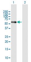 Anti-MATN1 Mouse Polyclonal Antibody