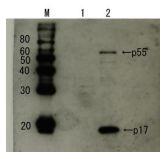 Anti-HIV1 p55 + p17 Antibod