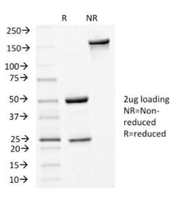 SDS-PAGE analysis of Anti-E Cadherin Antibody [CDH1/1525] under non-reduced and reduced conditions; showing intact IgG and intact heavy and light chains, respectively SDS-PAGE analysis confirms the integrity and purity of the antibody