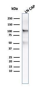 Western blot analysis of LNCap cell lysate using Anti-PSMA Antibody [FOLH1/3734]