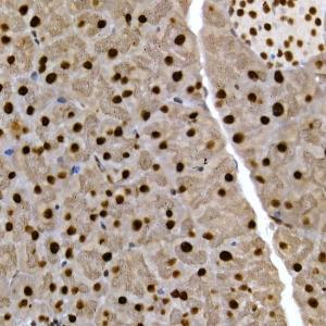 Immunohistochemistry analysis of paraffin-embedded mouse pancreas using Anti-SCAF4 Antibody (A308954) at a dilution of 1:50 (40X lens). Perform high pressure antigen retrieval with 10 mM citrate buffer pH 6.0 before commencing with IHC staining protocol