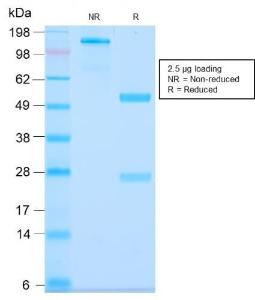 SDS-PAGE analysis of Anti-MUC3 Antibody [MUC3/2992R] under non-reduced and reduced conditions; showing intact IgG and intact heavy and light chains, respectively. SDS-PAGE analysis confirms the integrity and purity of the antibody